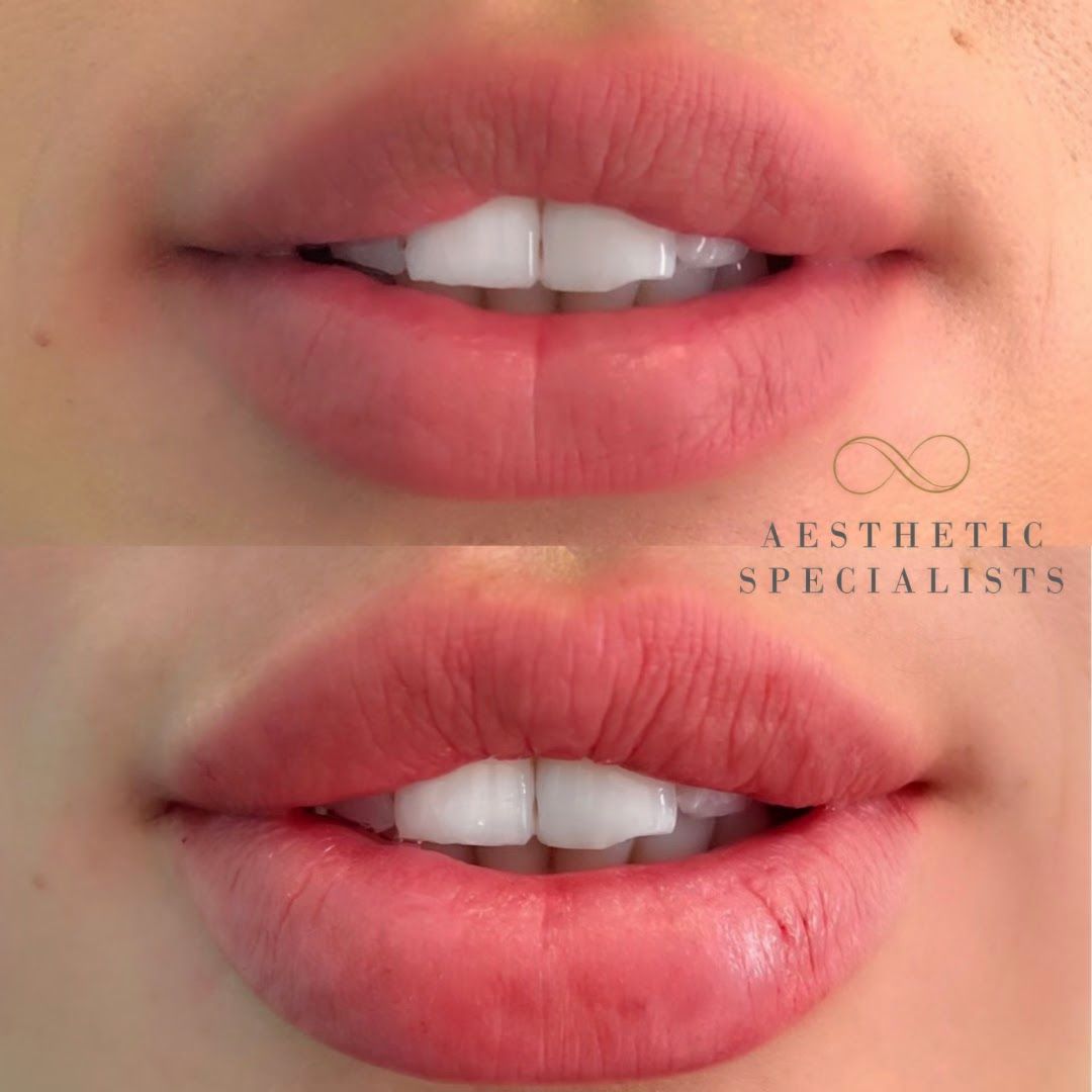 Allen Medical Aesthetics in Des Moines, WA