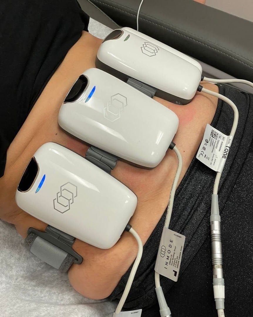 Volure MedSpa in Los Angeles, CA