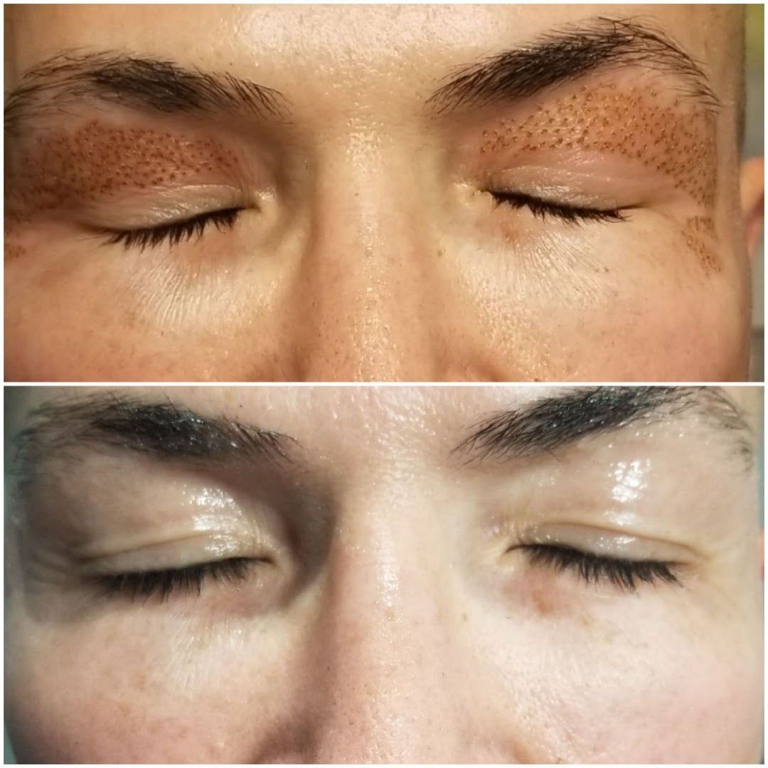 IVMEDSPA in Albuquerque, NM