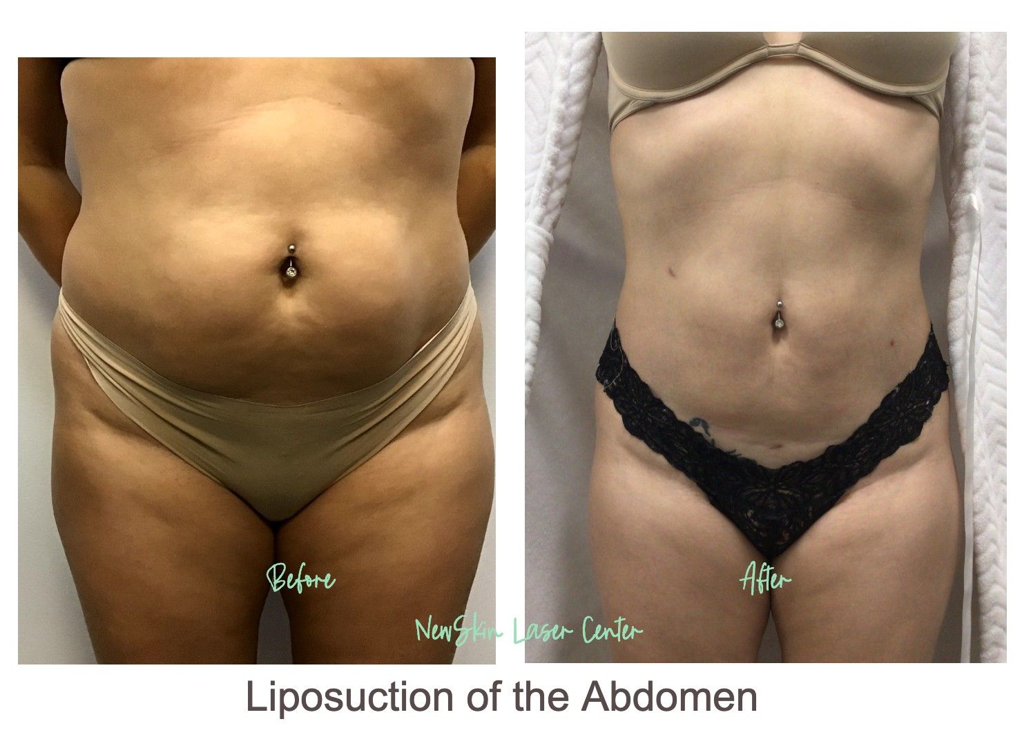 New Skin Laser Center in Los Angeles, CA