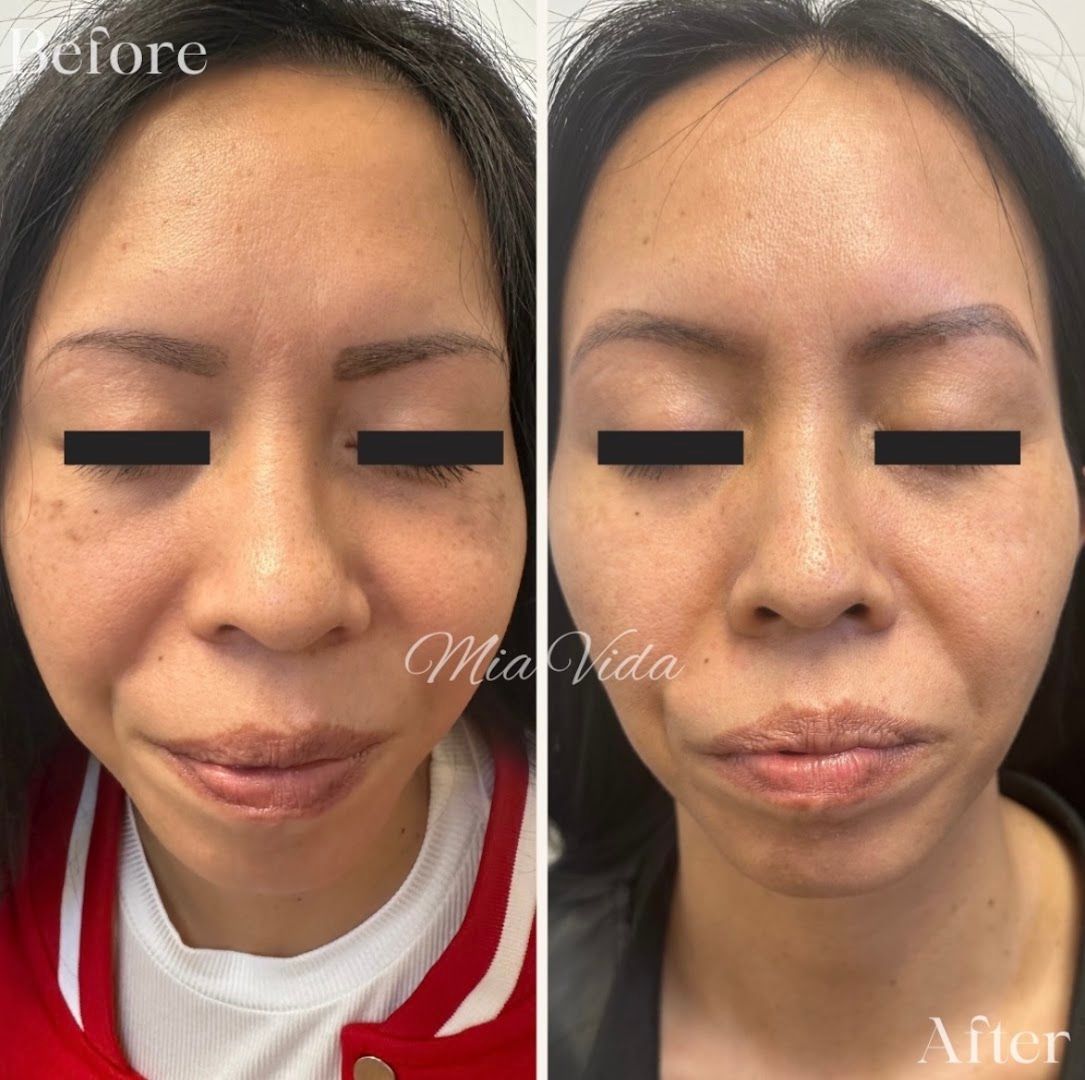 Mia Vida Aesthetics & Wellness in St Louis, MO