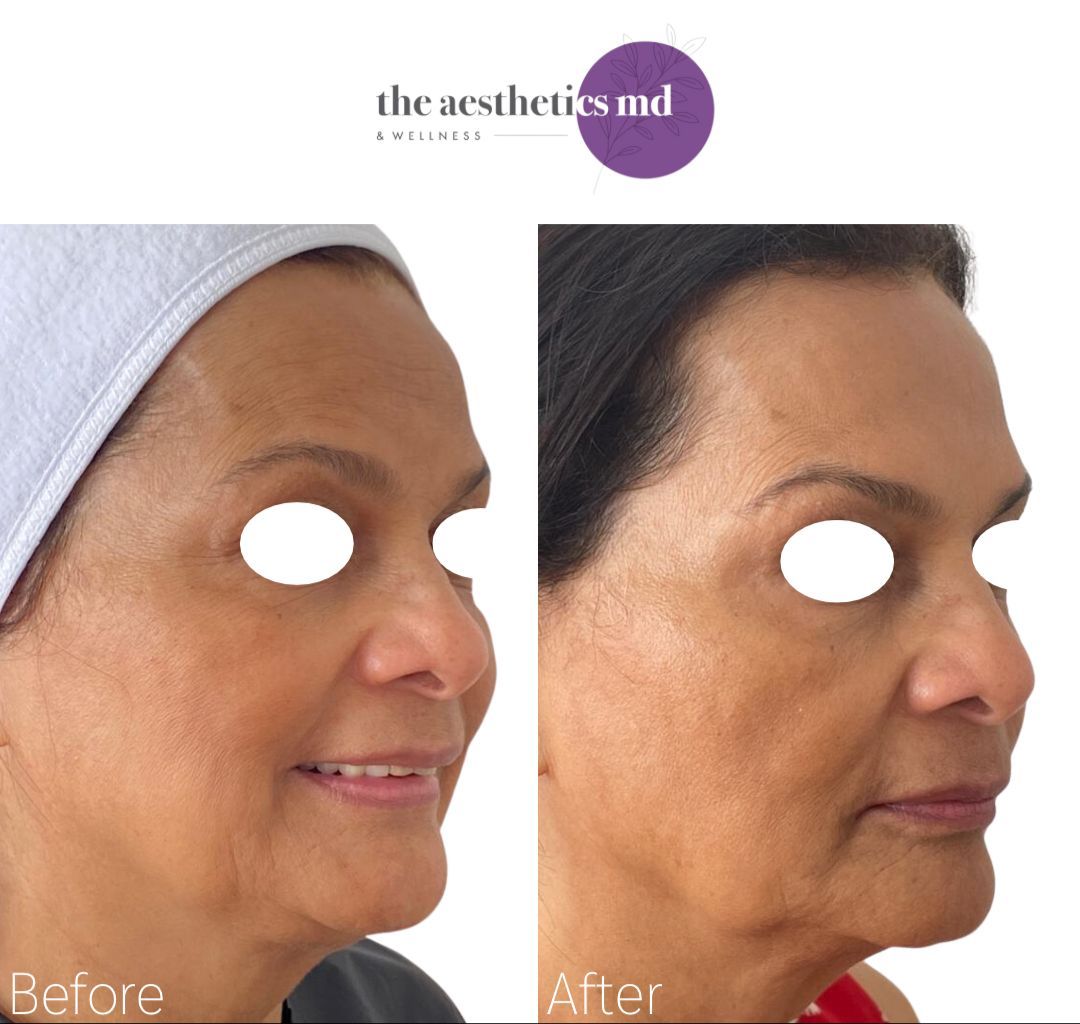 The Aesthetics Md & Wellness | Coral Gables & South Miami | Dermal Filler, Weight Loss, Laser, Cosmetic Med Spa in Coral Gables, FL