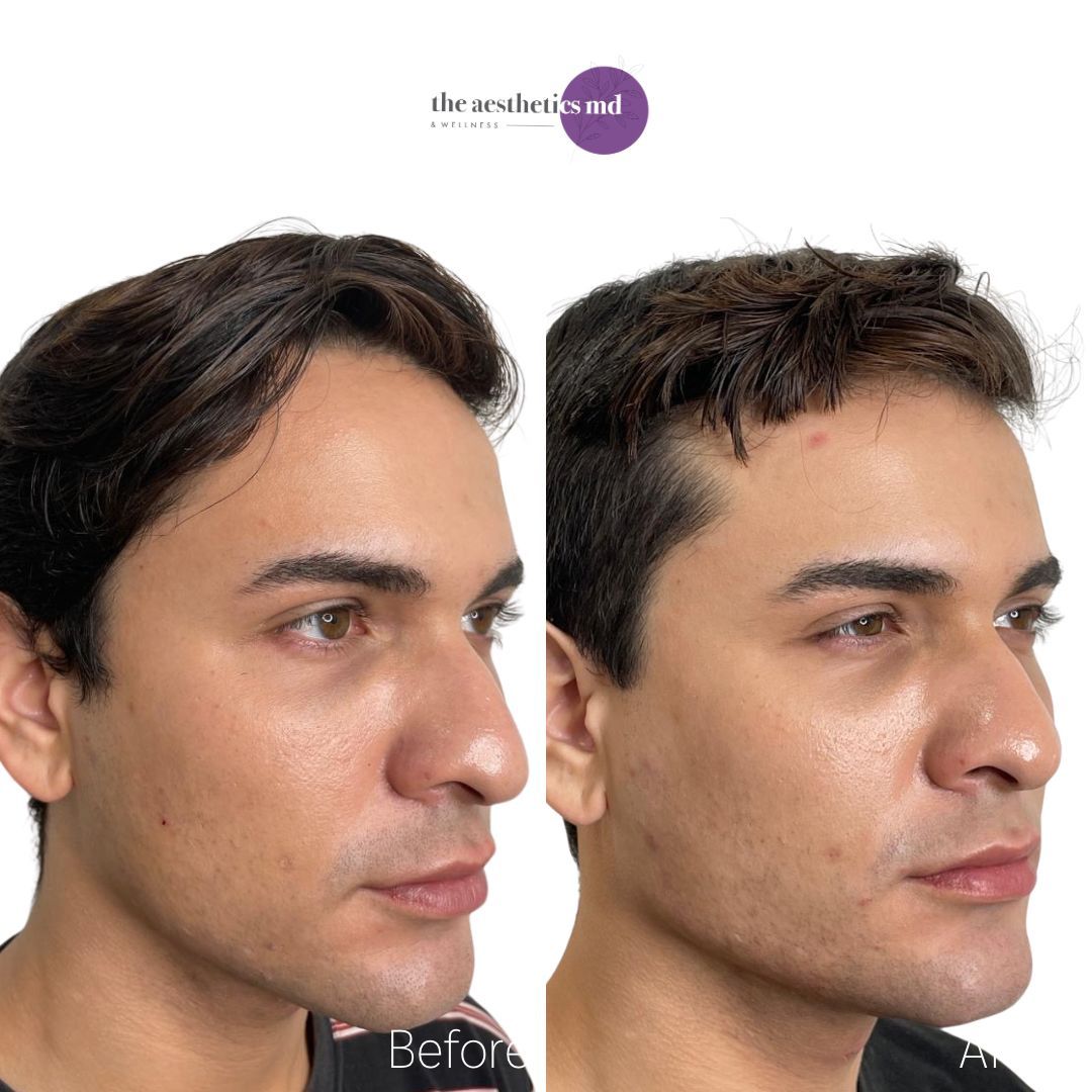 The Aesthetics Md & Wellness | Coral Gables & South Miami | Dermal Filler, Weight Loss, Laser, Cosmetic Med Spa in Coral Gables, FL