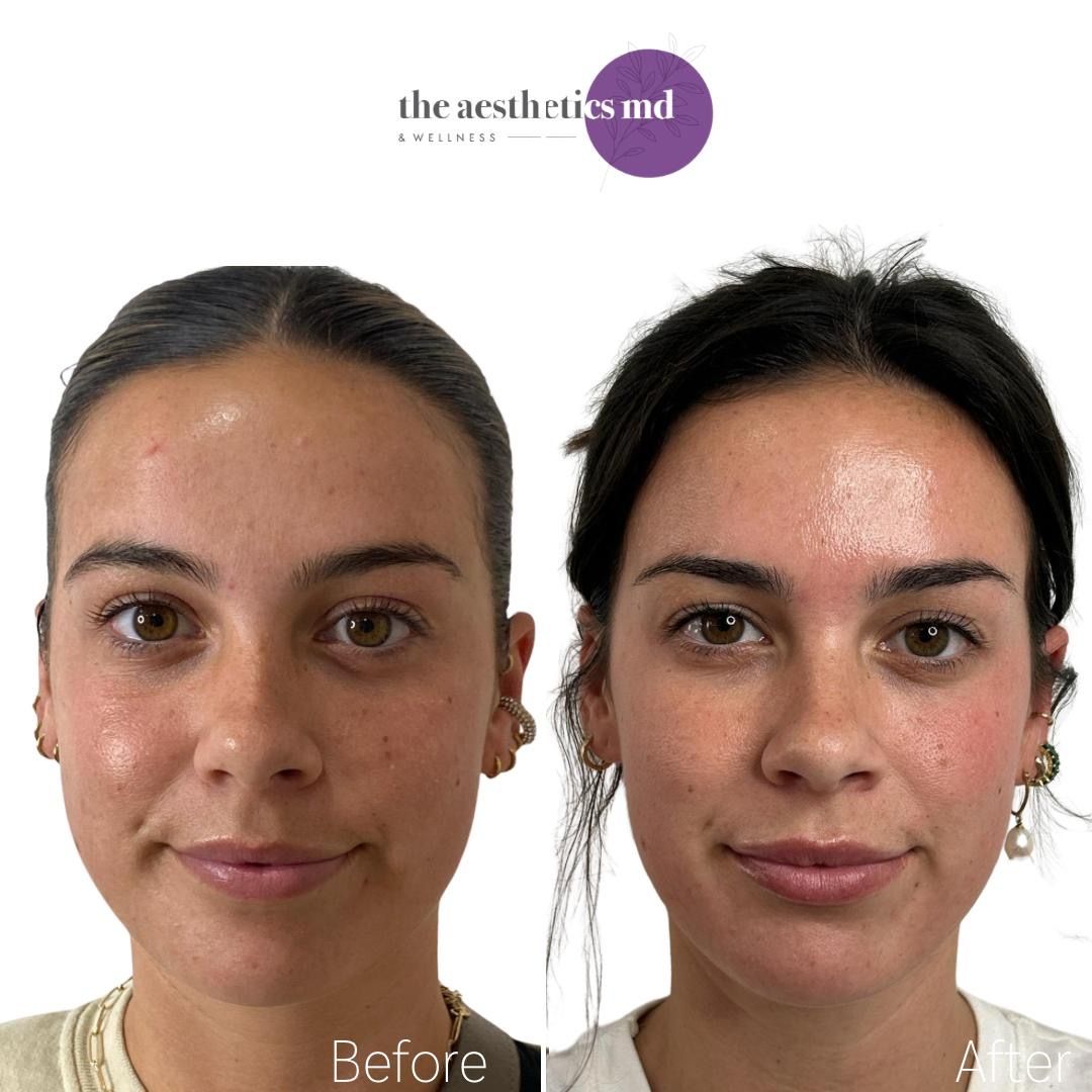 The Aesthetics Md & Wellness | Coral Gables & South Miami | Dermal Filler, Weight Loss, Laser, Cosmetic Med Spa in Coral Gables, FL