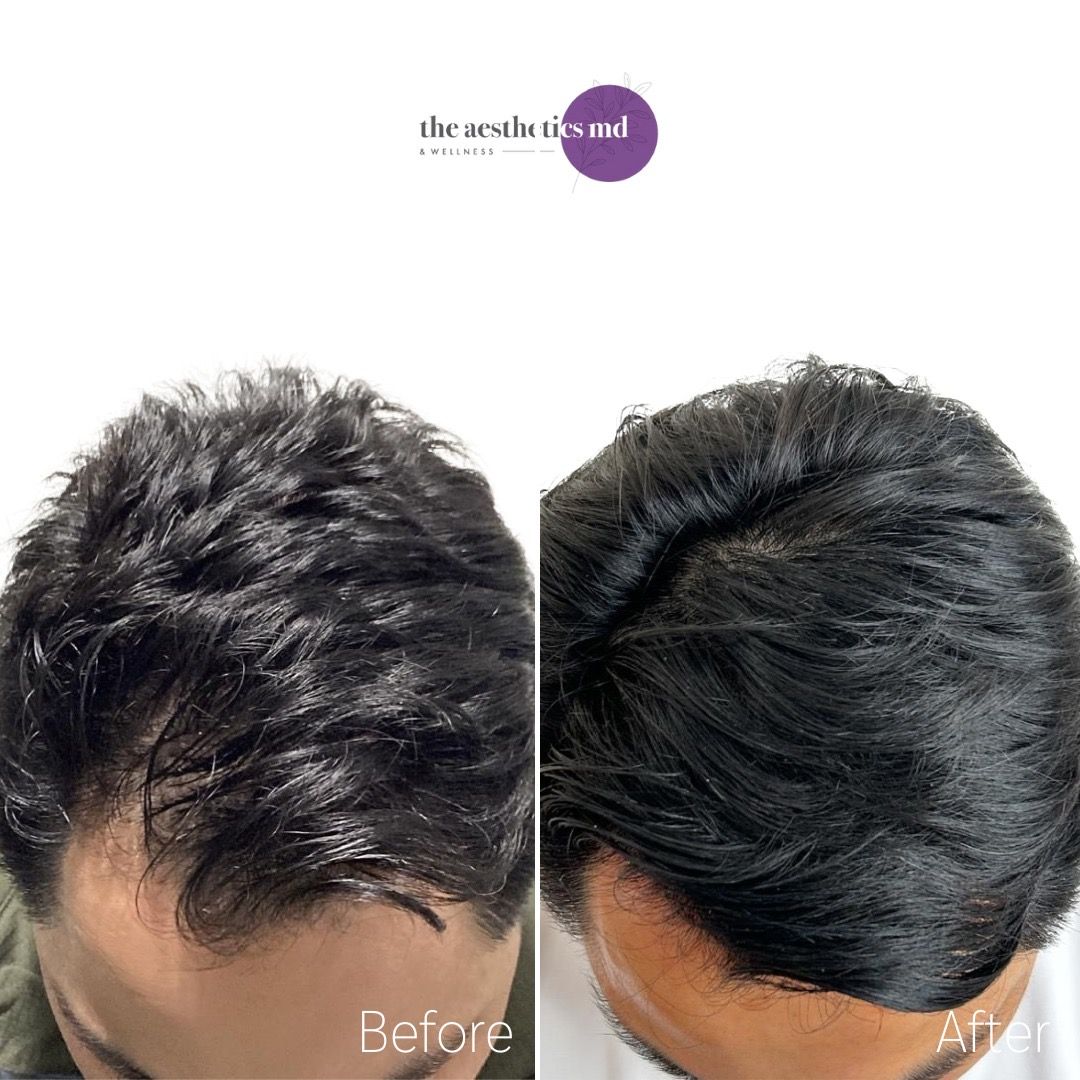 The Aesthetics Md & Wellness | Coral Gables & South Miami | Dermal Filler, Weight Loss, Laser, Cosmetic Med Spa in Coral Gables, FL