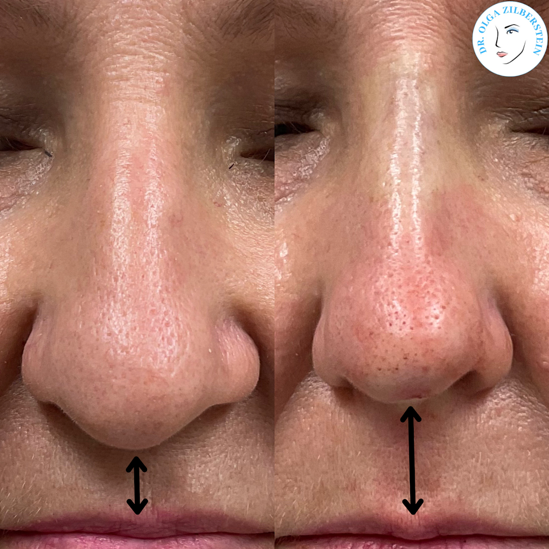 Dr. Olga Zilberstein Medical Aesthetics in Brooklyn, NY