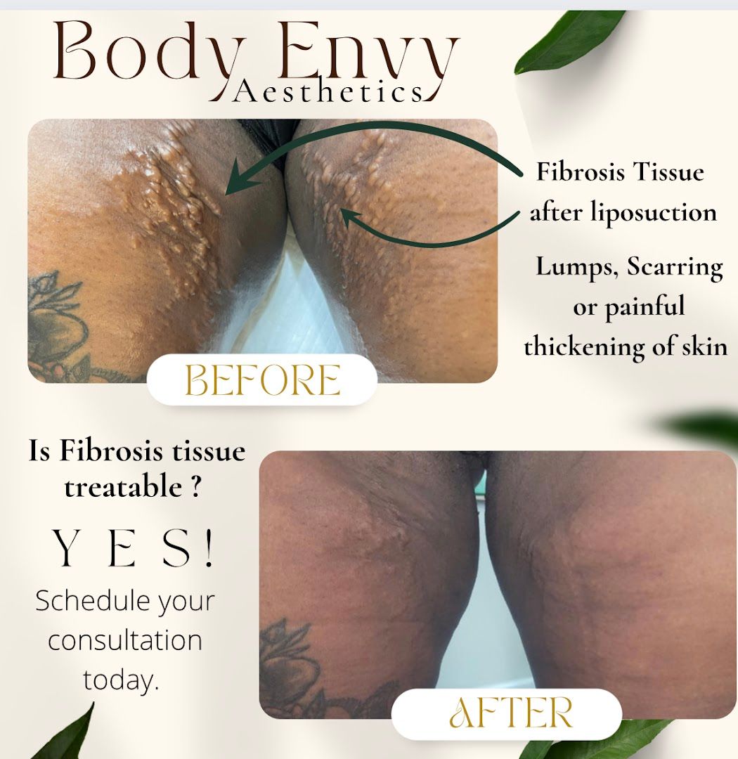 Body Envy Aesthetics in Tampa, FL