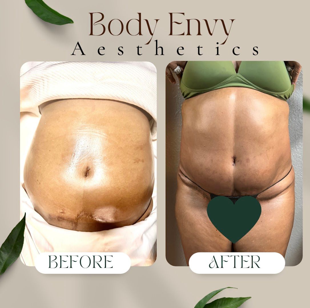Body Envy Aesthetics in Tampa, FL
