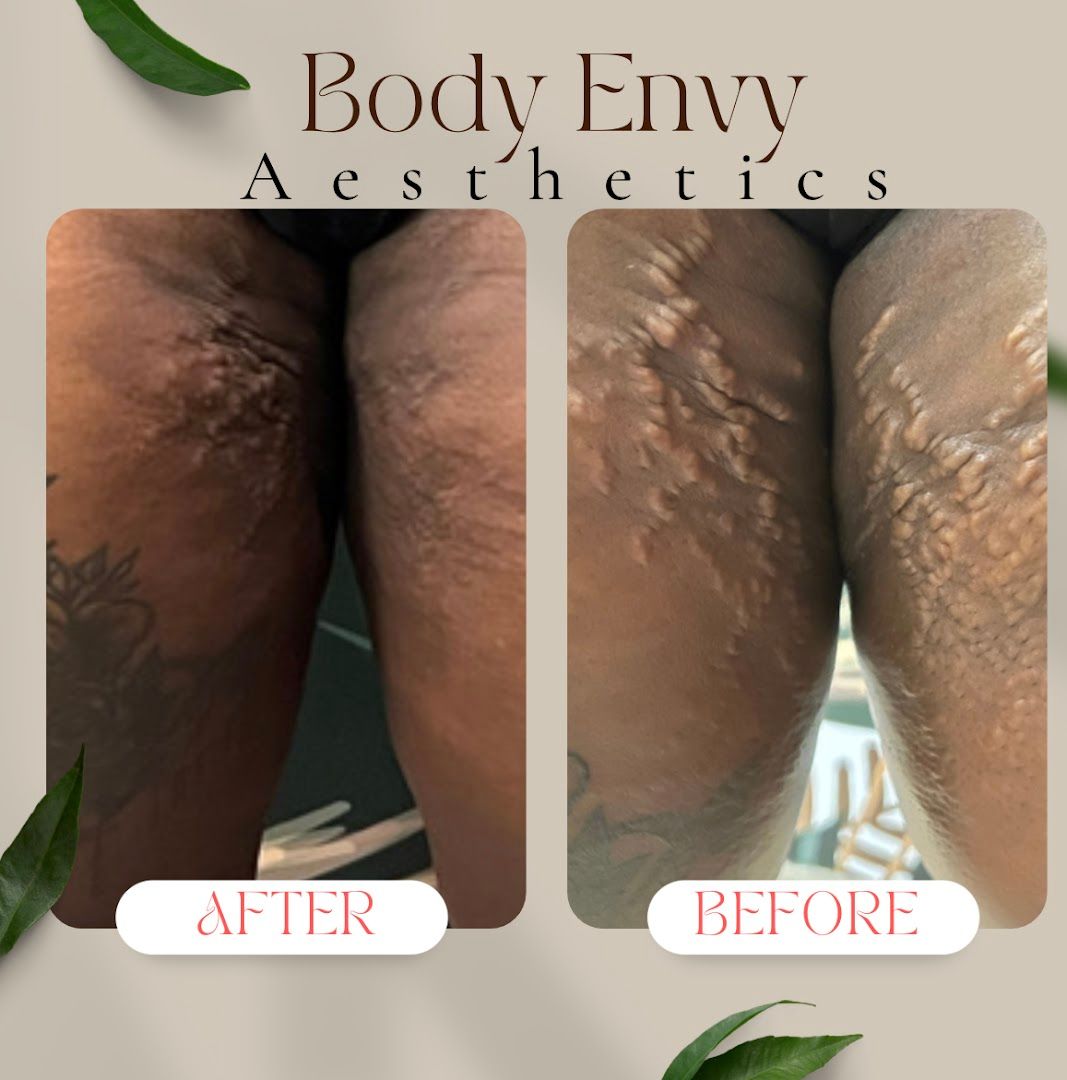 Body Envy Aesthetics in Tampa, FL