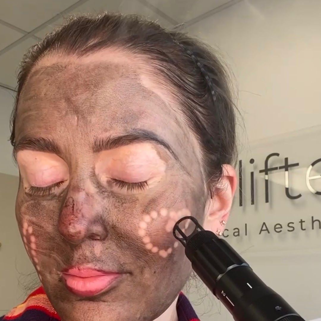 Uplifted Medical Aesthetics in Redondo Beach, CA