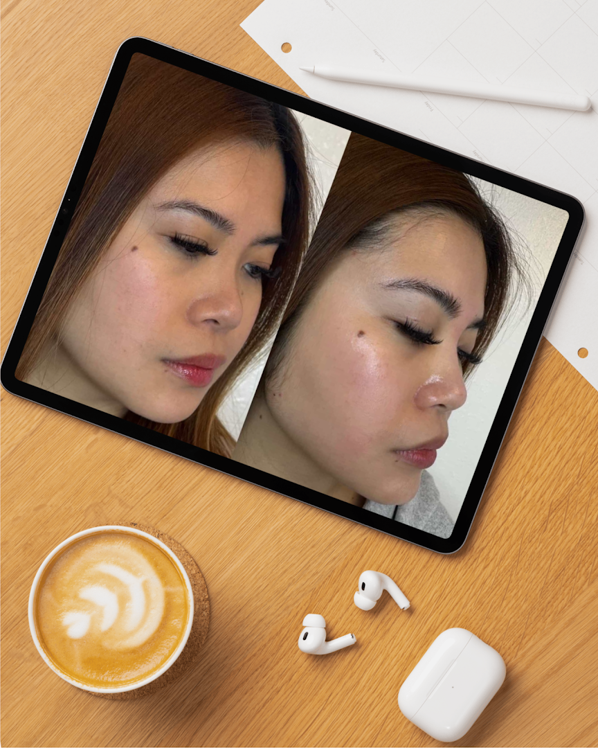 Glow in Grace Aesthetics in Carson, CA