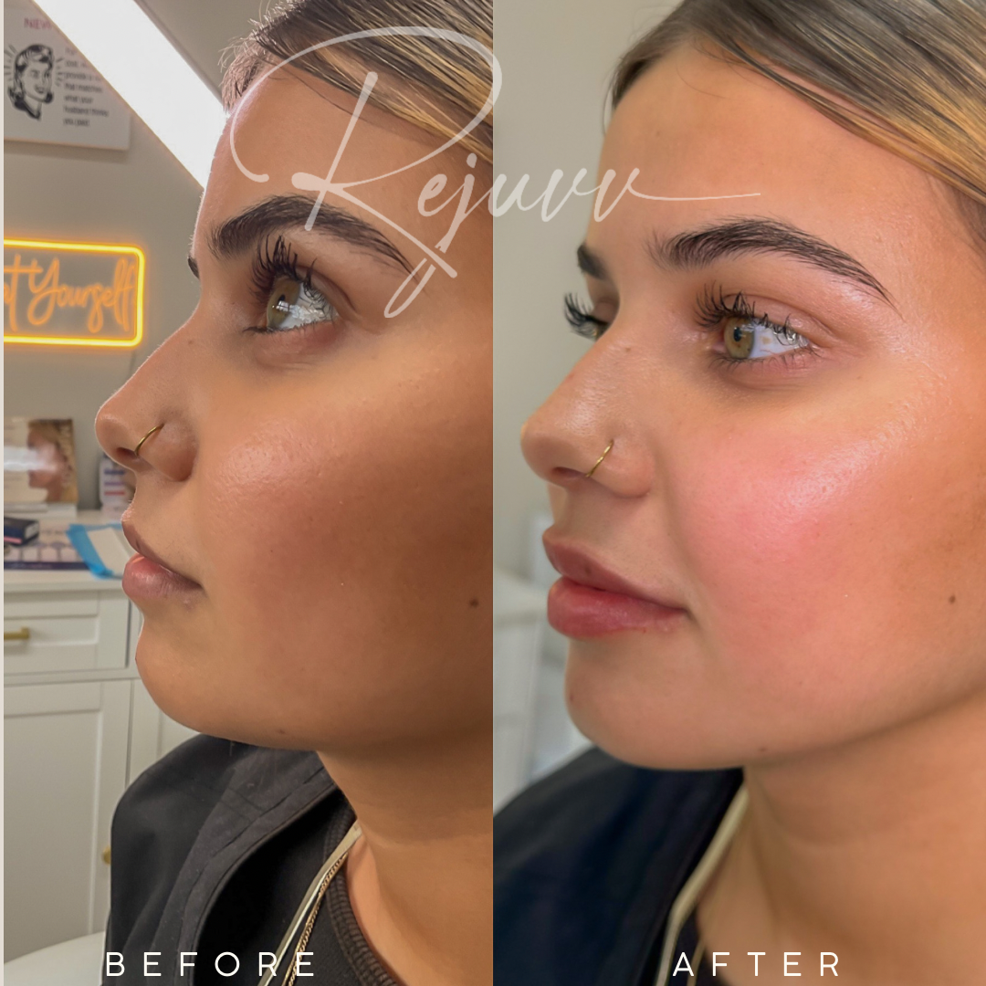 Rejuvv Aesthetics & Wellness in Miami, FL