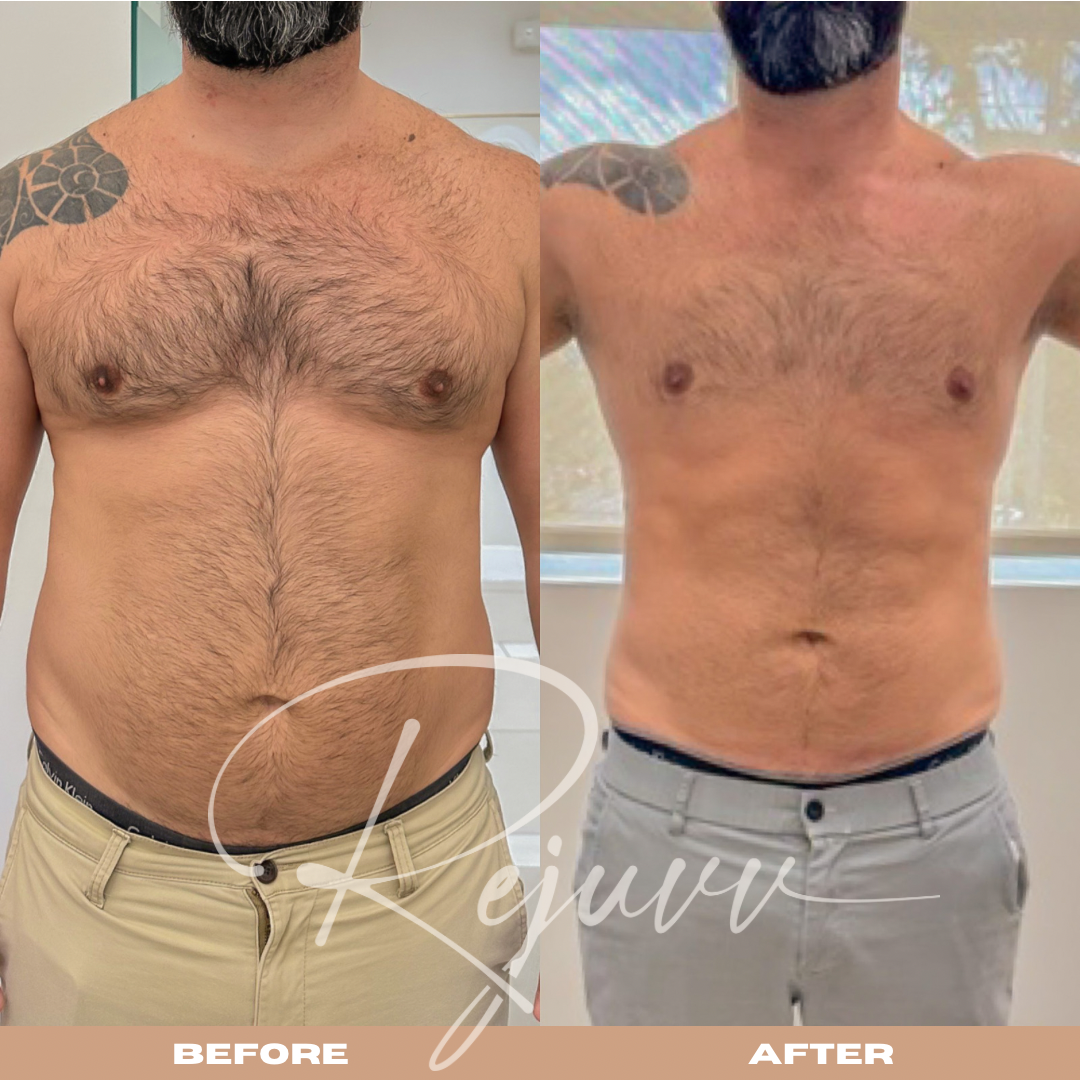 Rejuvv Aesthetics & Wellness in Miami, FL