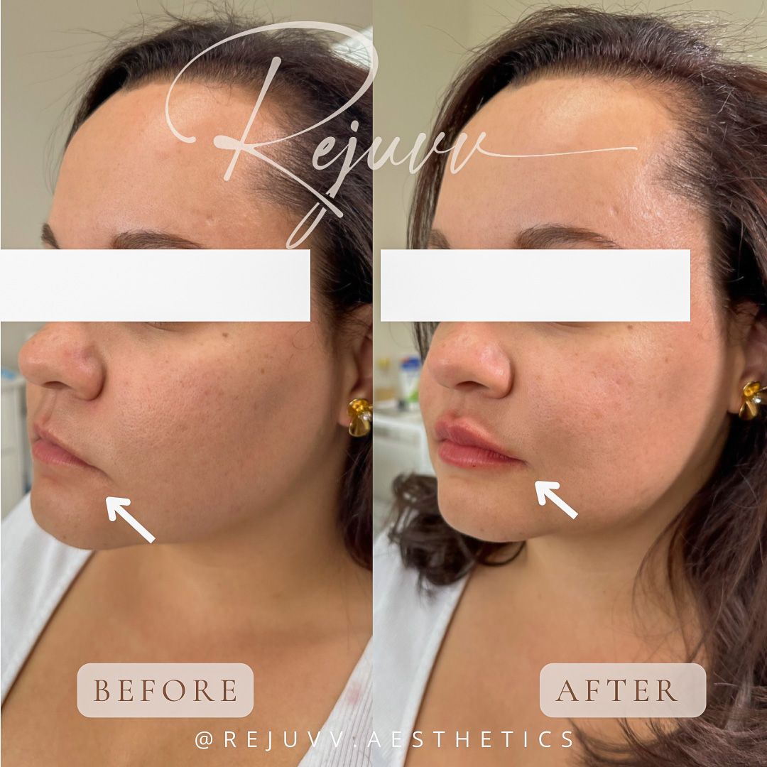 Rejuvv Aesthetics & Wellness in Miami, FL