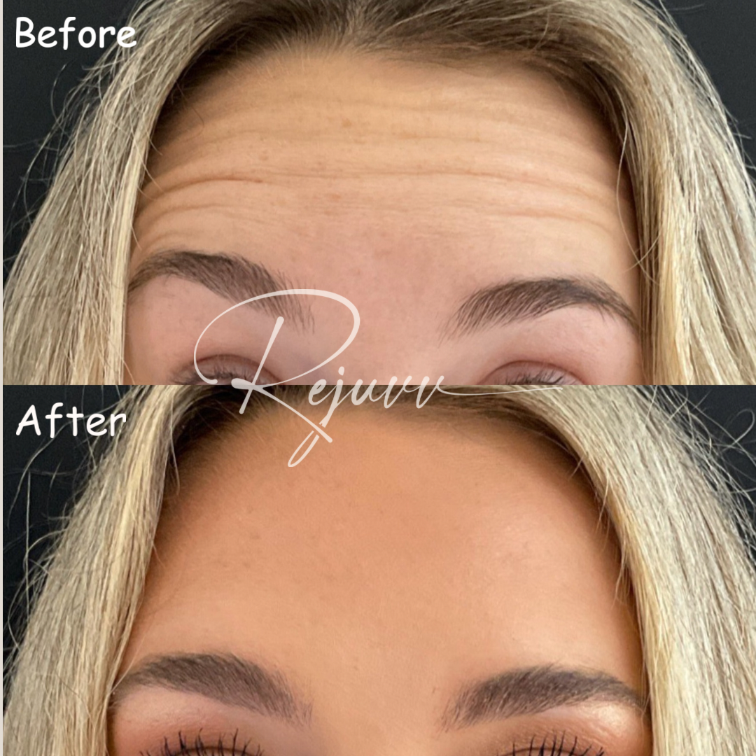 Rejuvv Aesthetics & Wellness in Miami, FL