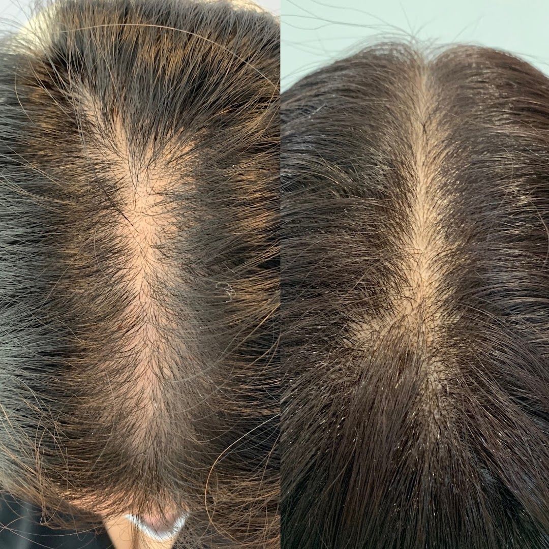 RejuvLA SKIN + HAIR in Los Angeles, CA