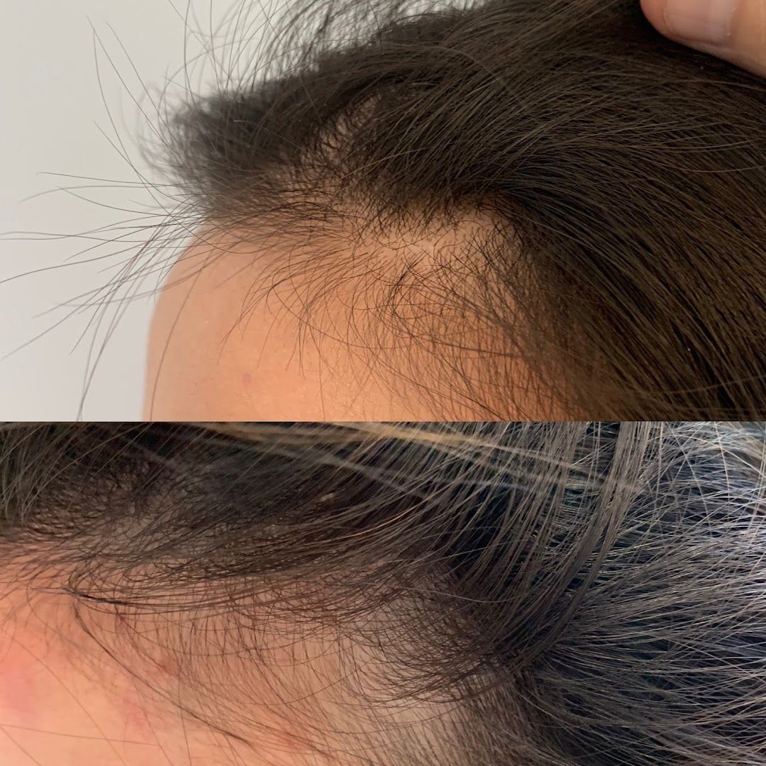 RejuvLA SKIN + HAIR in Los Angeles, CA