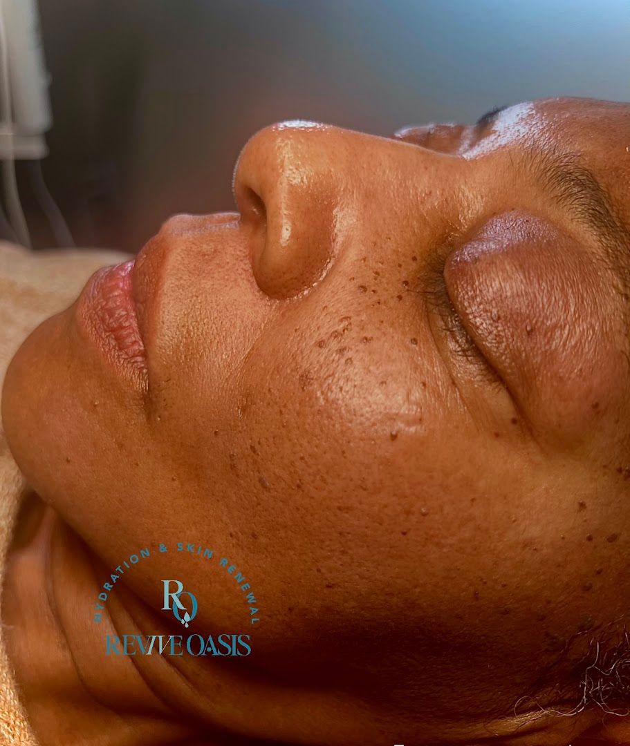 Revive Oasis Hydration and Skin Renewal in St Petersburg, FL