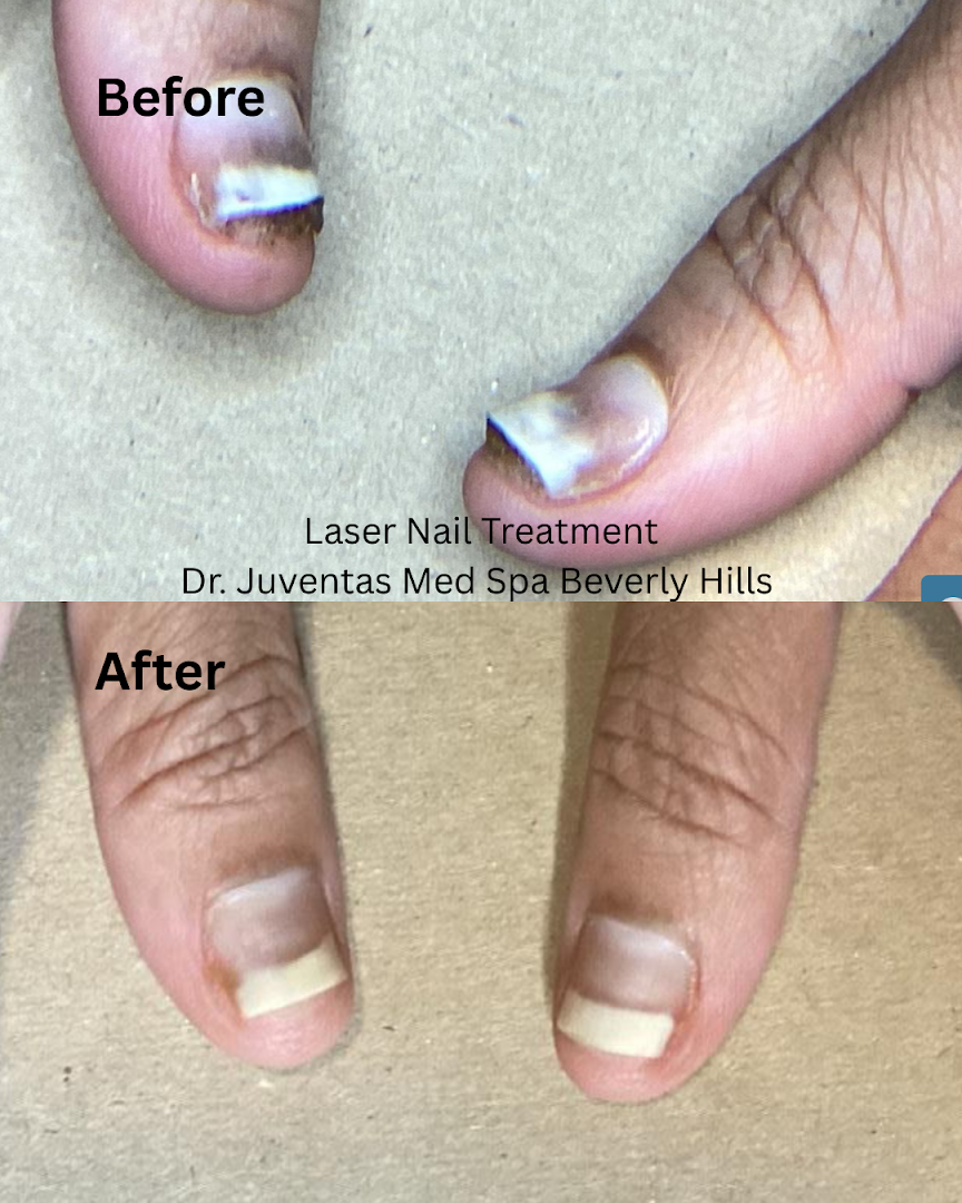 Dr. Juventas in Beverly Hills, CA