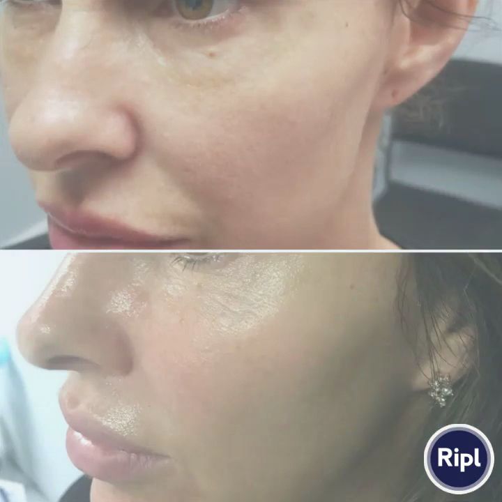 Fusion Medispa in Odessa, FL