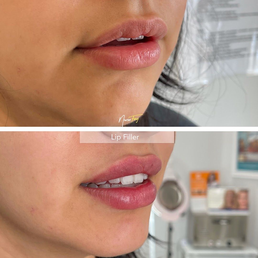 Spa Medica Aesthetic in Los Angeles, CA
