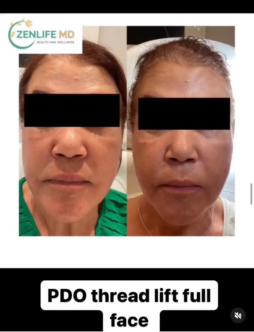 ZenLife MD in Tampa, FL