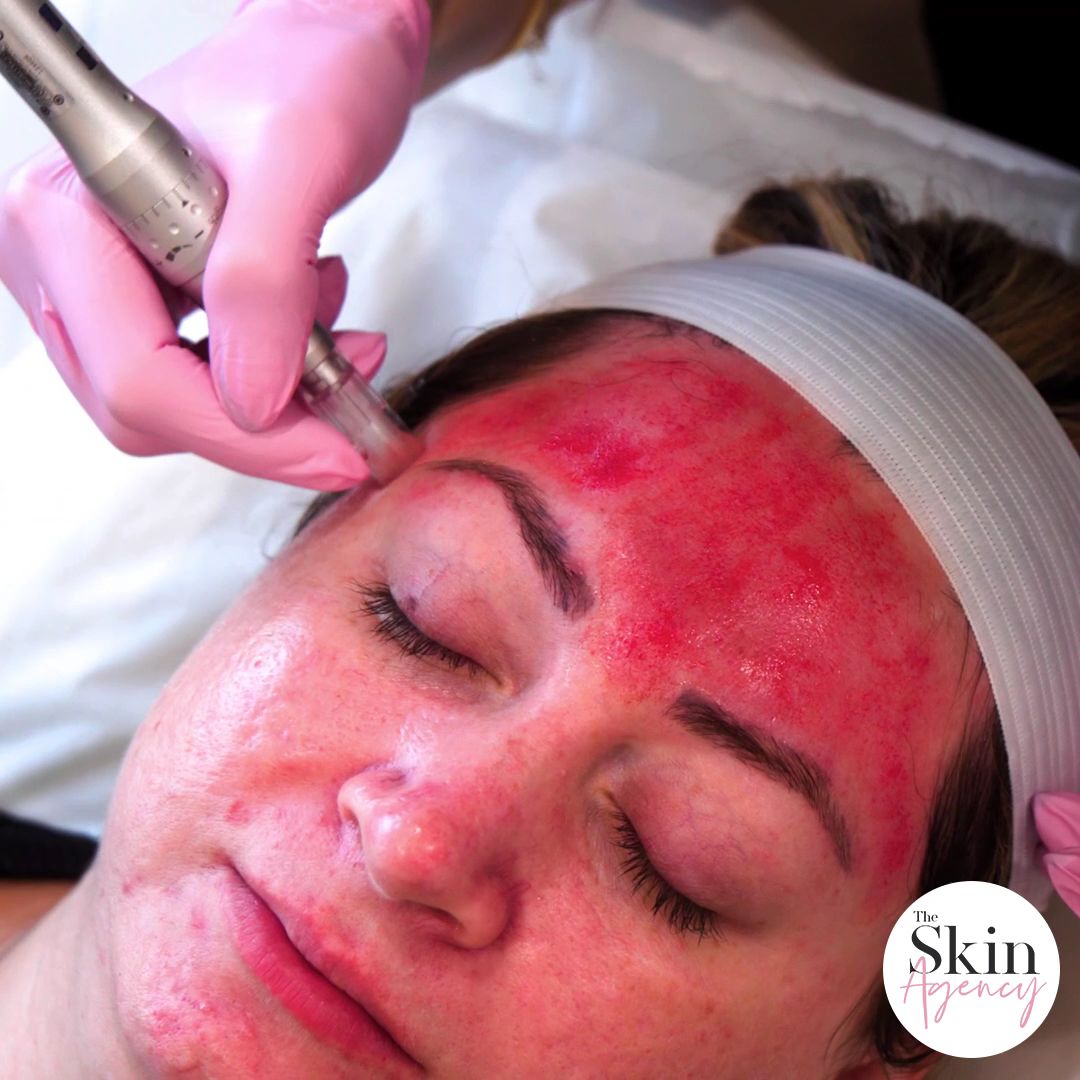 The Skin Agency in Los Angeles, CA